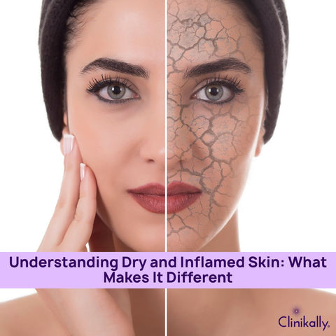 Understanding Dry and Inflamed Skin: What Makes It Different