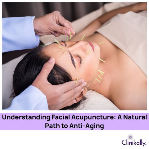 Understanding Facial Acupuncture: A Natural Path to Anti-Aging