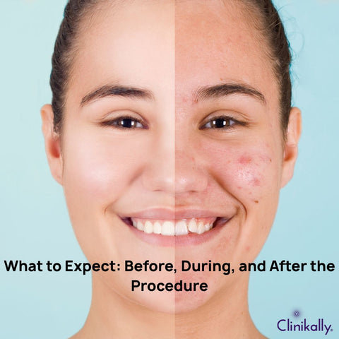 What to Expect: Before, During, and After the Procedure