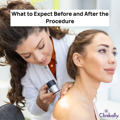 What to expect before and after a skin biopsy