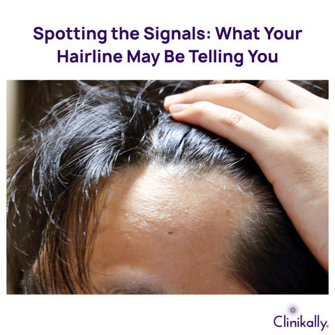 Spotting the Signals: What Your Hairline May Be Telling You