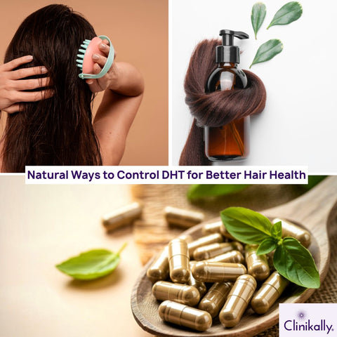 Natural Ways to Control DHT for Better Hair Health