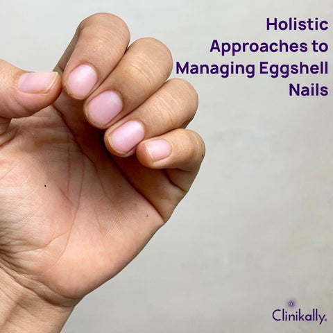 Holistic Approaches to Managing Eggshell Nails