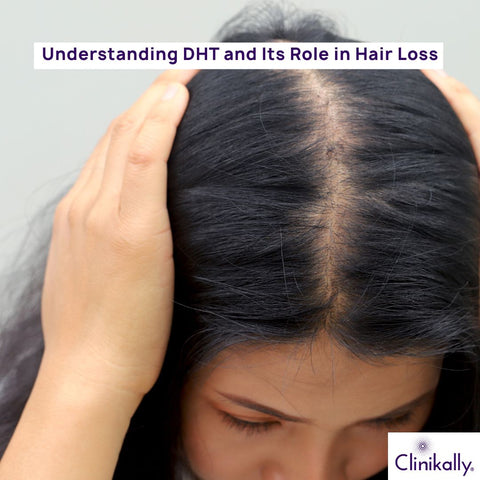 What is DHT and its Role in Hair Loss