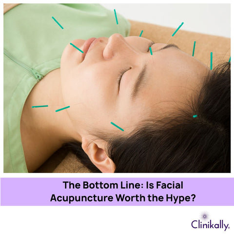 The Bottom Line: Is Facial Acupuncture Worth the Hype?