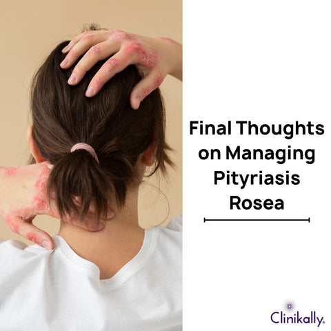 Final Thoughts on Managing Pityriasis Rosea