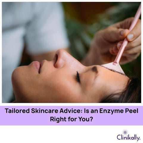Tailored Skincare Advice: Is an Enzyme Peel Right for You?