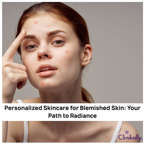 Personalized Skincare for Blemished Skin: Your Path to Radiance