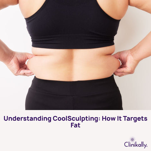 Understanding CoolSculpting: How It Targets Fat