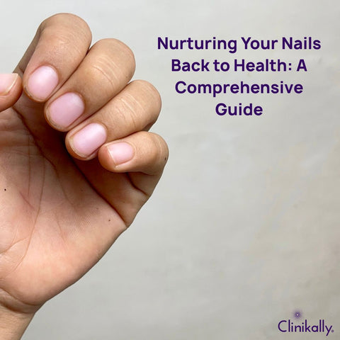 Nurturing Your Nails Back to Health: A Comprehensive Guide