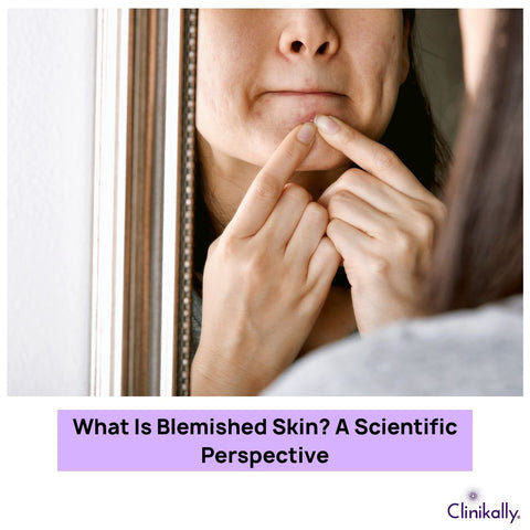 What Is Blemished Skin? A Scientific Perspective