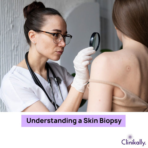 Understanding a Skin Biopsy