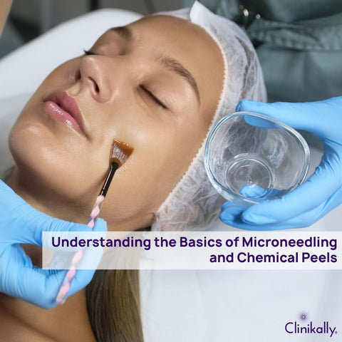Understanding the Basics of Microneedling and Chemical Peels