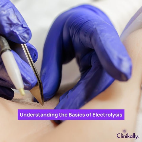 Understanding the Basics of Electrolysis