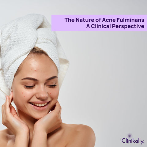 The Nature of Acne Fulminans: A Clinical Perspective