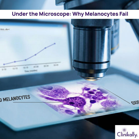 Under the Microscope: Why Melanocytes Fail