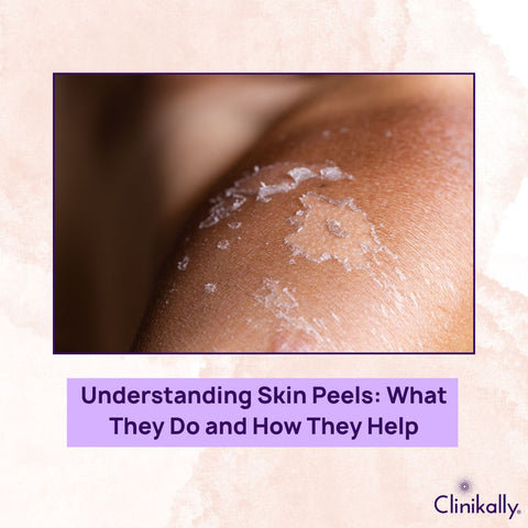 Understanding Skin Peels: What They Do and How They Help