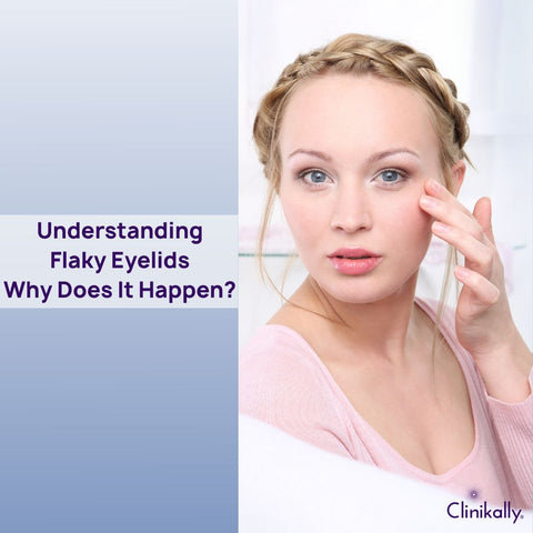 Understanding Flaky Eyelids: Why Does It Happen?