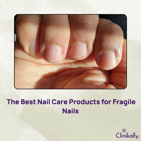 The Best Nail Care Products for Fragile Nails