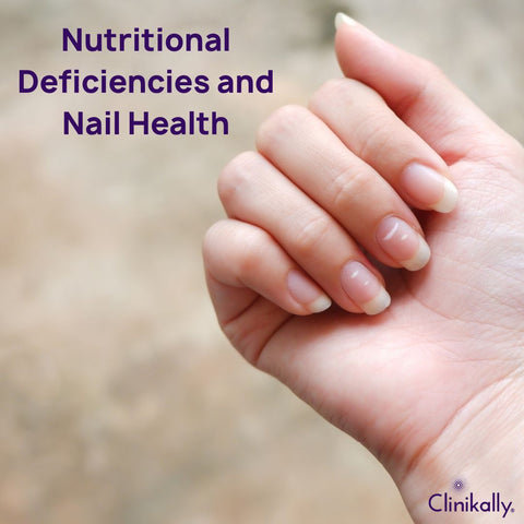 Nutritional Deficiencies and Nail Health
