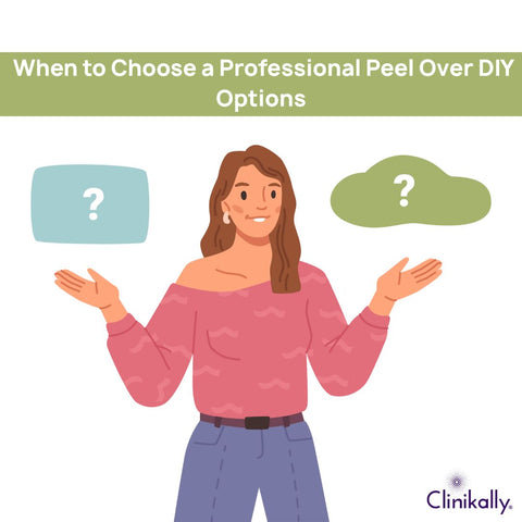 When to Choose a Professional Peel Over DIY Options