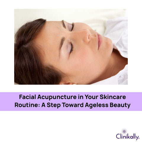 Facial Acupuncture in Your Skincare Routine: A Step Toward Ageless Beauty