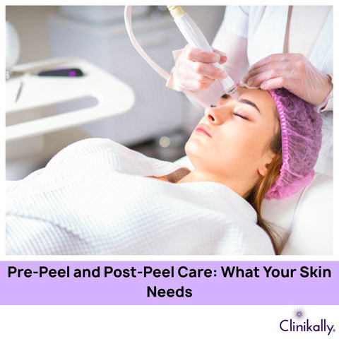 Pre-Peel and Post-Peel Care: What Your Skin Needs