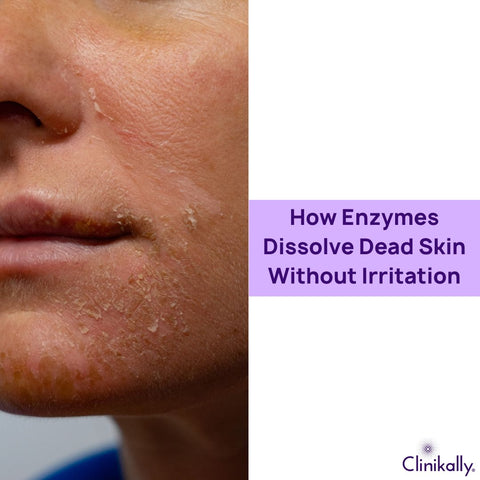 How Enzymes Dissolve Dead Skin Without Irritation