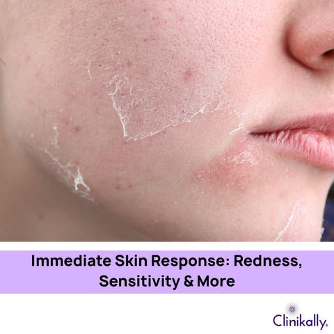 Immediate Skin Response: Redness, Sensitivity & More