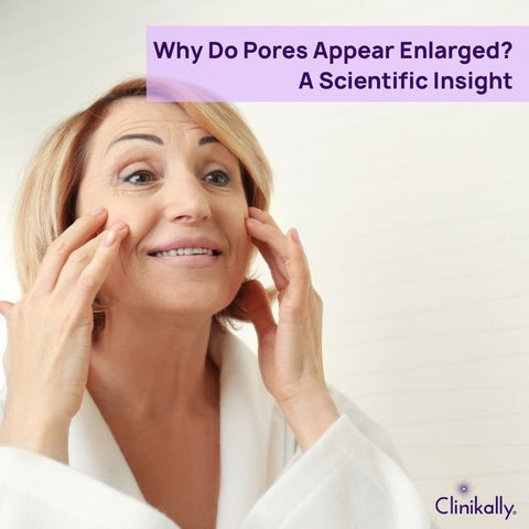 Why Do Pores Appear Enlarged? A Scientific Insight