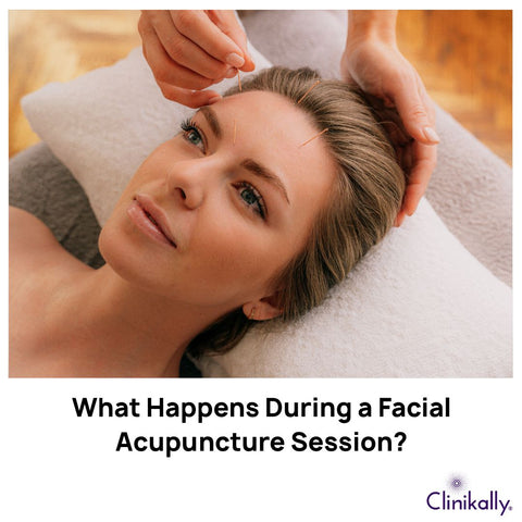 What Happens During a Facial Acupuncture Session?