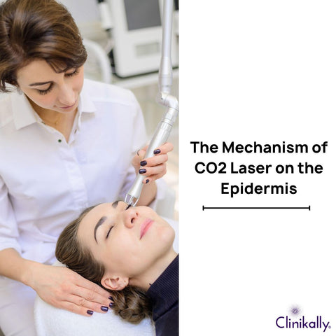 The Mechanism of CO2 Laser on the Epidermis