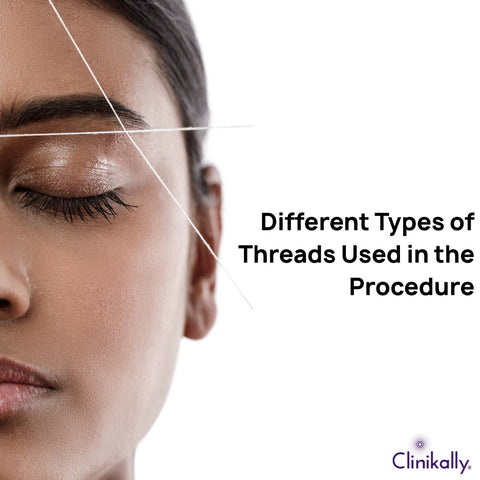 Different Types of Threads Used in the Procedure