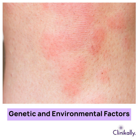 Genetic and Environmental Factors