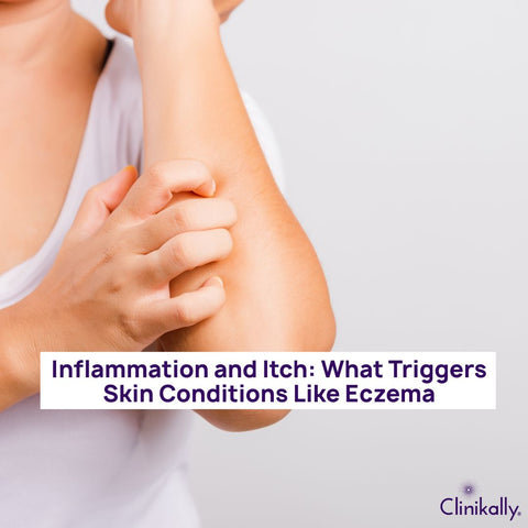 Inflammation and Itch: What Triggers Skin Conditions Like Eczema