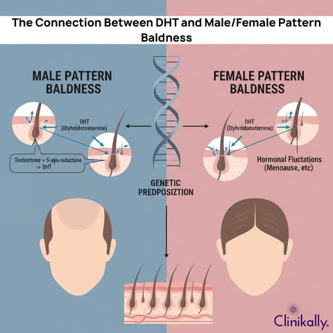 The Connection Between DHT and Male/Female Pattern Baldness