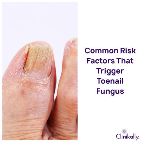 Common Risk Factors That Trigger Toenail Fungus