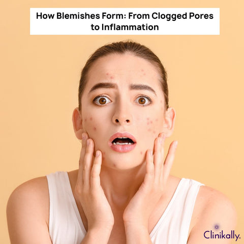 How Blemishes Form: From Clogged Pores to Inflammation