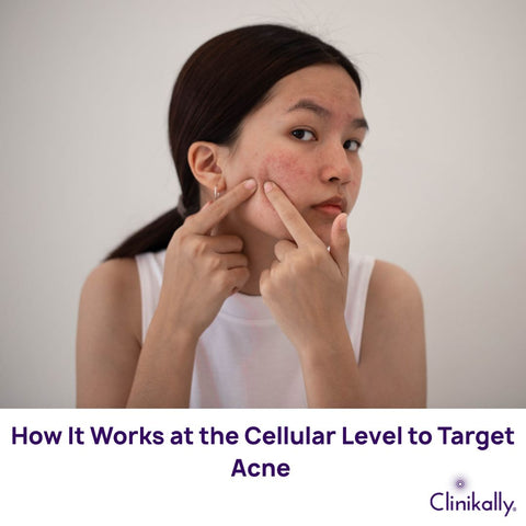 How It Works at the Cellular Level to Target Acne