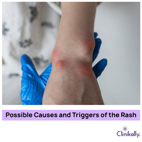 Possible Causes and Triggers of the Rash