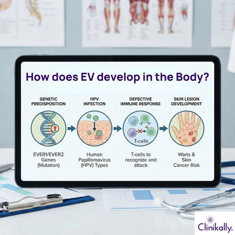 How does EV develop in the Body?