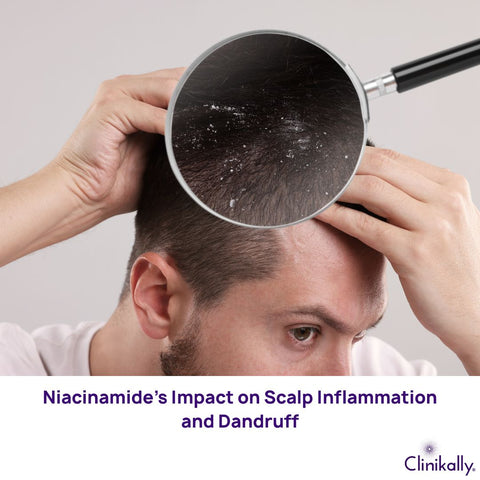 Niacinamide’s Impact on Scalp Inflammation and Dandruff