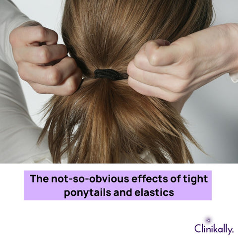 The not-so-obvious effects of tight ponytails and elastics