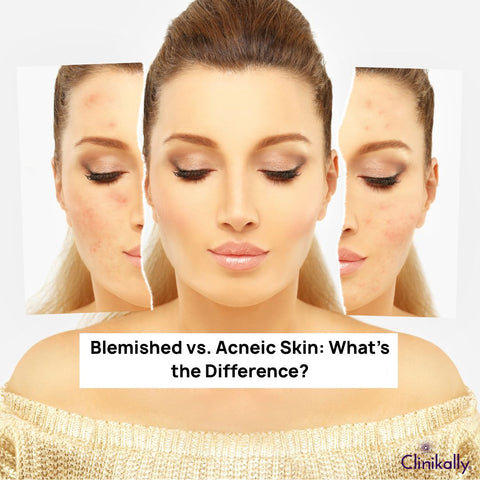 Difference Between Blemished and Acneic Skin