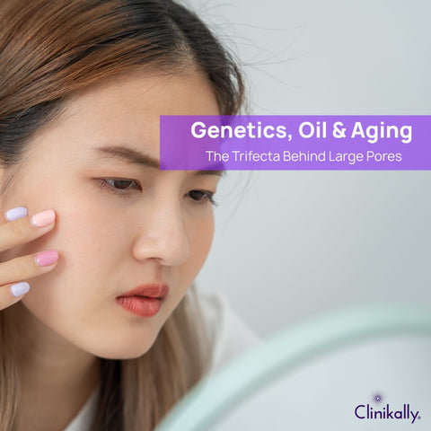 Genetics, Oil &amp; Aging: The Trifecta Behind Large Pores