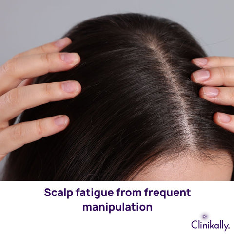 Scalp fatigue from frequent manipulation