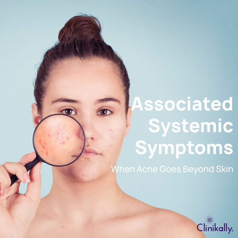 Associated Systemic Symptoms: When Acne Goes Beyond Skin