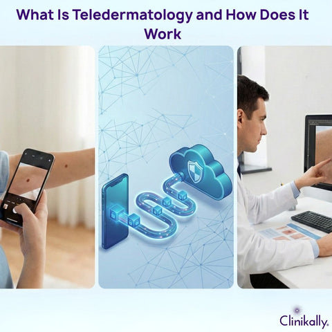 What Is Teledermatology and How Does It Work?