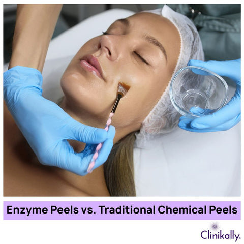 Enzyme Peels vs. Traditional Chemical Peels