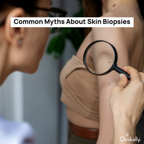 Common Myths About Skin Biopsies